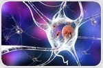 Immuno-infrared sensor identifies Alzheimer's disease in the blood up to 17 years in advance